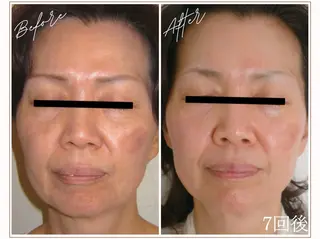 MYubelle ミューベルのエステ・リラクイメージ