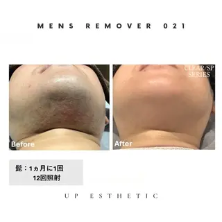 メンズ アイブロウ 韓国肌管理 ウプエステティックのエステ・リラクイメージ