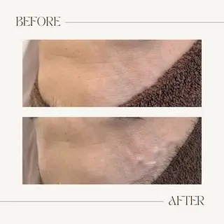 1st｜フェイシャル エステ専門店のエステ・リラクイメージ