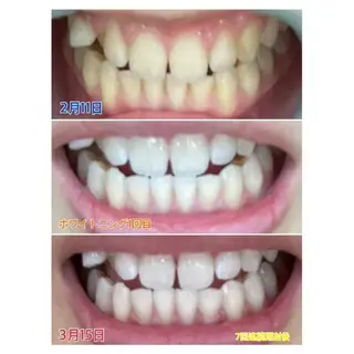 M渋谷 ホワイトニングのエステ・リラクイメージ