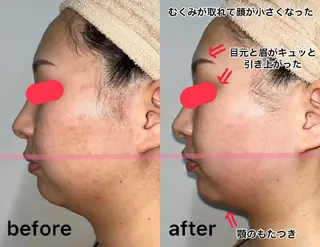 メンズ salonde ReGodのエステ・リラクイメージ