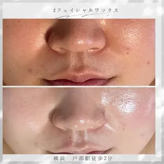 アイブロウ 代表 MOMOのエステ・リラクイメージ