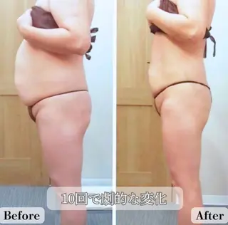 骨格デザイナー 💎菊地💎のエステ・リラクイメージ