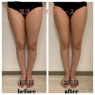 リンパマッサージ mimozaのエステ・リラクイメージ