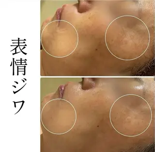 ハーブピーリング専門 BIOPLUS+川崎のエステ・リラクイメージ