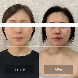 小顔×肌質改善 《お顔の印象》のエステ・リラクイメージ