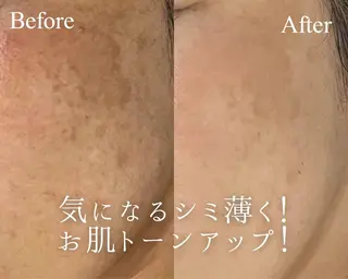 村上 玲奈のエステ・リラクイメージ