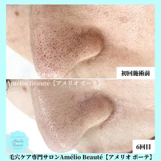 毛穴ケア専門サロン アメリオボーテのその他イメージ