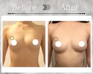 Feliz(ユーカリレンタルサロン内)所属・【バストケアサロン】 Feliz フェリスのエステ・リラクイメージ