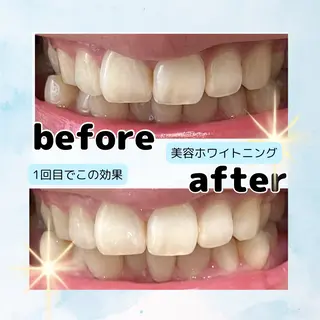 ホワイトニングサロン Soleilのその他イメージ