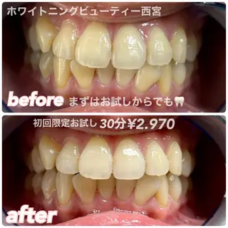 ホワイトニングビュー ティー西宮店のその他イメージ