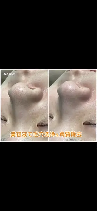 M 🌱naturalのエステ・リラクイメージ