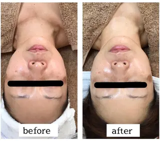 肌悩み改善 〜エステサロン〜のエステ・リラクイメージ