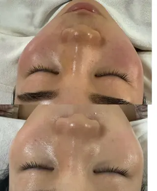 マツエク・マツパ 愛維美水光美肌専門店所属・愛維美水光美肌専門店 メンズレディースokのエステ・リラクイメージ