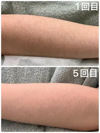 脱毛サロン ミュー松山本店のエステ・リラクイメージ