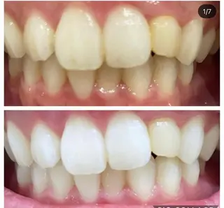 ホワイトニングサロン_ホワイト福島所属・ホワイトニング ホワイトのその他イメージ