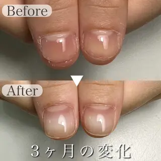 ネイル 深爪専門店 サロンリリーのネイルデザイン