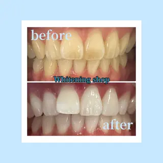 ホワイトニングショップ光明池店所属・ホワイトニング ショップ光明池店のエステ・リラクイメージ