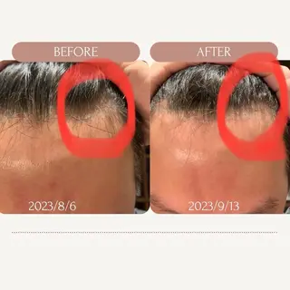 メンズ 痩身・脱毛・美髪ケア 【GLYCINE】のエステ・リラクイメージ