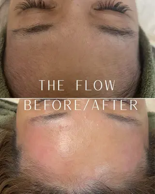 アイブロウ 稲垣 優のエステ・リラクイメージ