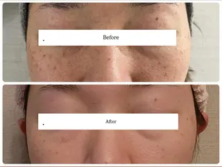 ANABEL+所属・肌の質を変えるエステ 🤍🫧Nanaのエステ・リラクイメージ