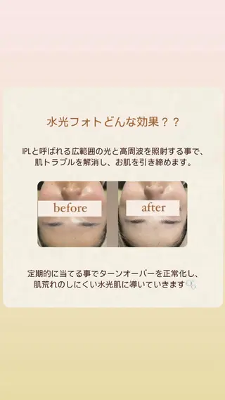 【韓国肌管理・脱毛】 クレセントのその他イメージ