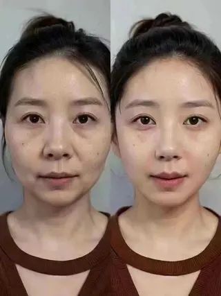 ショート aliaハーブ水光店 エステティシャン募集のエステ・リラクイメージ