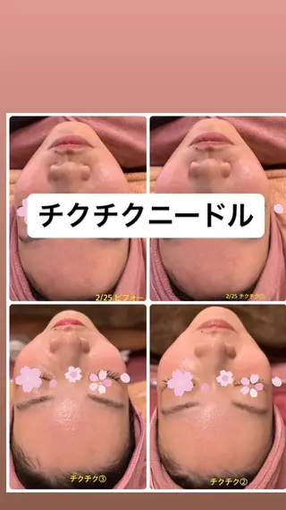 Lien オーナー　山口智嘉のエステ・リラクイメージ