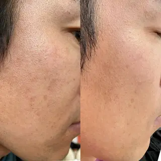 【福岡市西区 エステ】 GRANVIR(グランヴィール)所属・GRANVIR グランヴィールのエステ・リラクイメージ