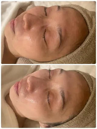 中目黒ハーブピーリン グ🌿ララピールのエステ・リラクイメージ