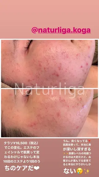 舟橋 優衣のエステ・リラクイメージ