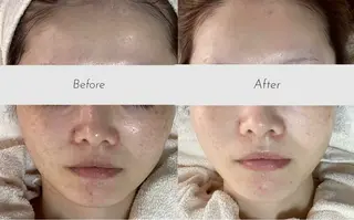 都度払い 肌質改善専門サロンのエステ・リラクイメージ