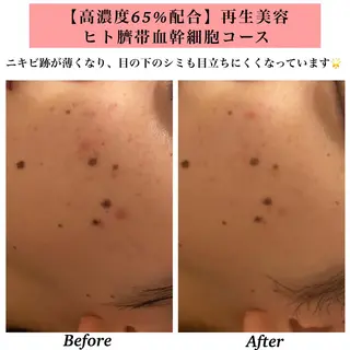 Bellesthe (ベルエステ)のエステ・リラクイメージ