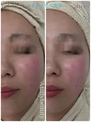 Amily beauty 毛利のエステ・リラクイメージ