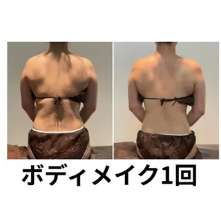 筋膜リリースエステ ESENCIAのエステ・リラクイメージ