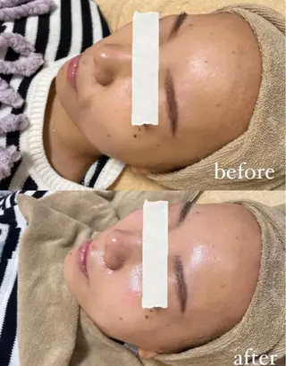 エステサロン Mi-mi.iのエステ・リラクイメージ