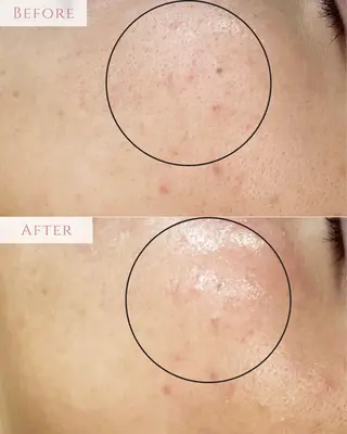 肌質改善専門サロン Bellmi/心斎橋のエステ・リラクイメージ