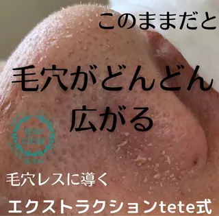 【毛穴専門店】 瑞江|yukaのエステ・リラクイメージ