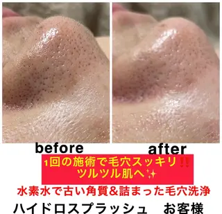 ネイル・エステサロン UILANIのネイルデザイン