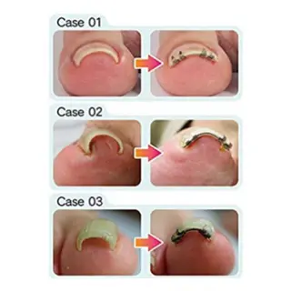 メンズ キッズ ネイル 🌱 ま し お 🌱のその他イメージ