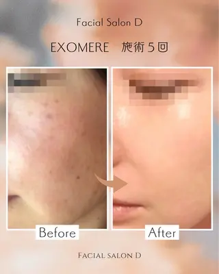 facial salon D 吉沢のエステ・リラクイメージ