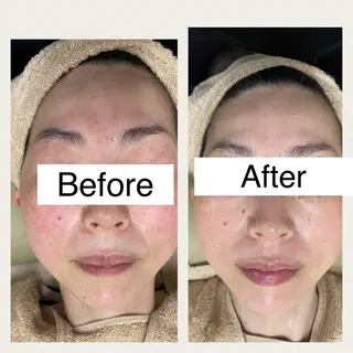 サロンドチェリー 《我妻》のエステ・リラクイメージ