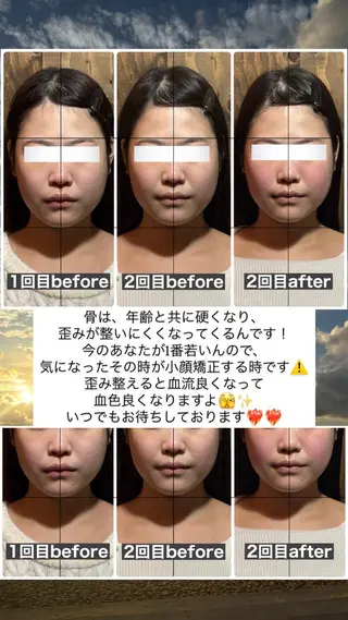 💎後悔させない小顔 矯正💎イトヤマ🌱のエステ・リラクイメージ