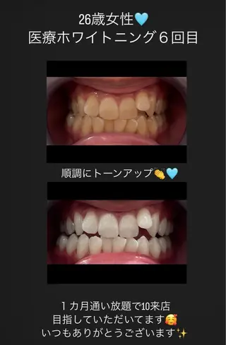 Kaula ホワイトニング🦷✨のエステ・リラクイメージ