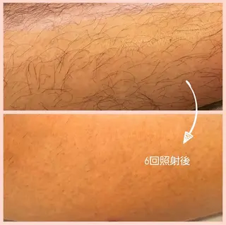 private脱毛salon HALE所属・private脱毛 salon HALEのエステ・リラクイメージ