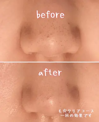 Natsumi エステティックサロンのエステ・リラクイメージ