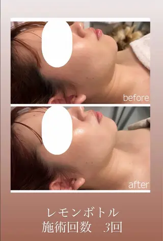 Raviy 【痩身・韓国肌管理】のエステ・リラクイメージ