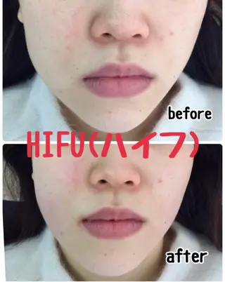肌質改善サロン chouchouのエステ・リラクイメージ