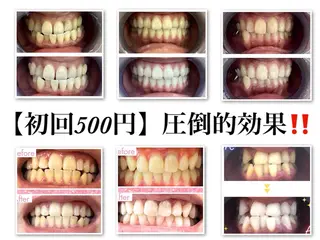 Lulu Nail所属・エクシア ホワイト 宇治小倉店のその他イメージ