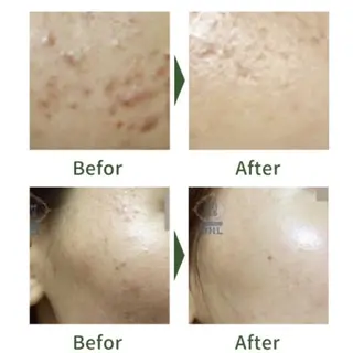 Belsia 千歳烏山のマツエク・マツパデザイン